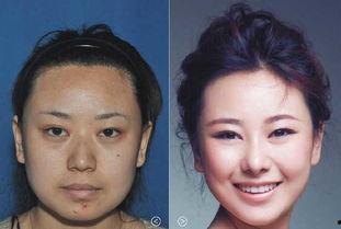 女孩整容照片,揭秘女孩整容前后对比照